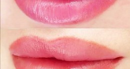 2022 Dudak Pigmentasyonu İşlem Fiyatları Ne Kadar? En İyi Klinikler Hangileri?