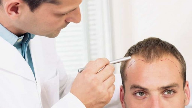 En İyi Saç Ekim Merkezleri Yorumlar 2023 Saç Ekimi