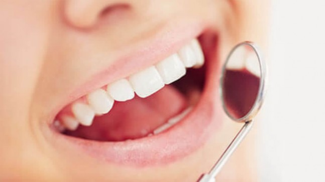 Kaplama Diş Nedir? Nasıl Uygulanır? En İyi Kaplama Diş Yapan Diş Hekimleri…