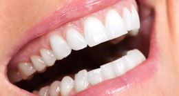 Implant fiyatları 2022 yılında ne kadar? En iyi implant Yapan Diş Hekimleri? Nasıl Uygulanır