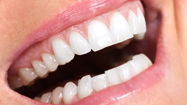 Implant fiyatları 2022 yılında ne kadar? En iyi implant Yapan Diş Hekimleri? Nasıl Uygulanır