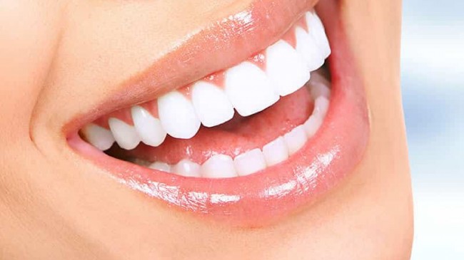 Diş Dolgusu Nasıl Yapılır? Diş Dolgusu Yaptırırken Dikkat Edilmesi Gerekenler